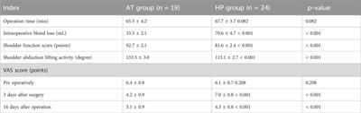 Efficacy of allogeneic tendon material coracoclavicular ligament reconstruction combined with Kirschner wire and titanium alloy hook plate material fixation in the treatment of acromioclavicular joint dislocation